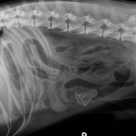 Intestinal foreign body